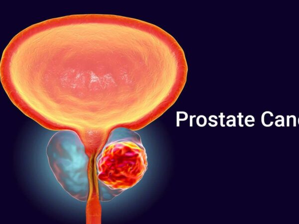 Suspected metastasis of prostate cancer Alamogordo