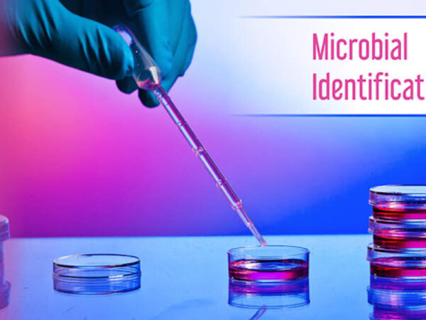 Microbial Identification Market Growth